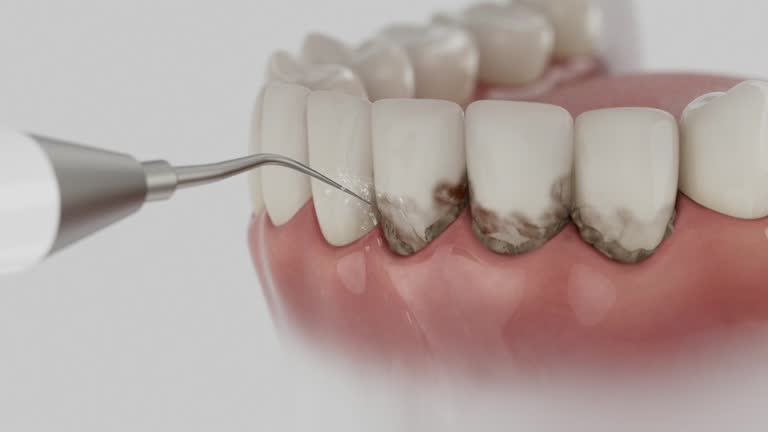 Trusted Wisdom Tooth Removal service in Hilton, NY - Dentist Open Now